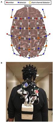 Phase-dependent Brain Activation of the Frontal and Parietal Regions During Walking After Stroke - An fNIRS Study